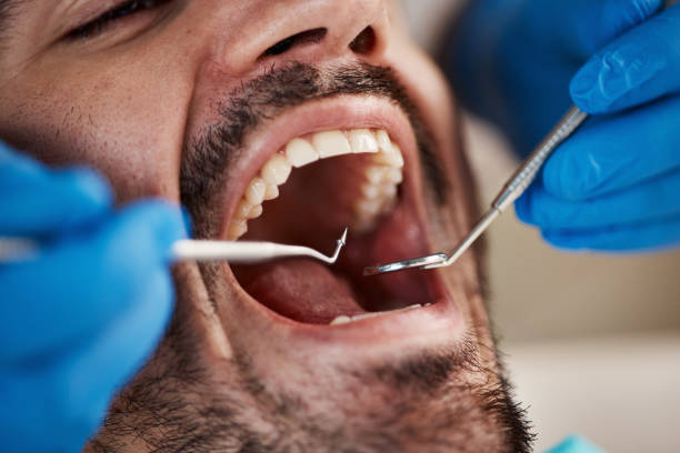 Best Emergency Broken Tooth Repair in Sanger, CA
